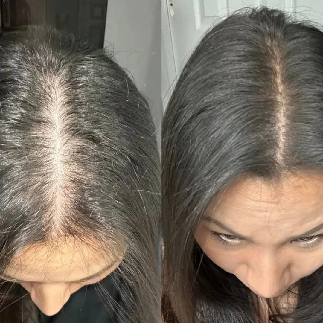 Apex Hair Mulheres