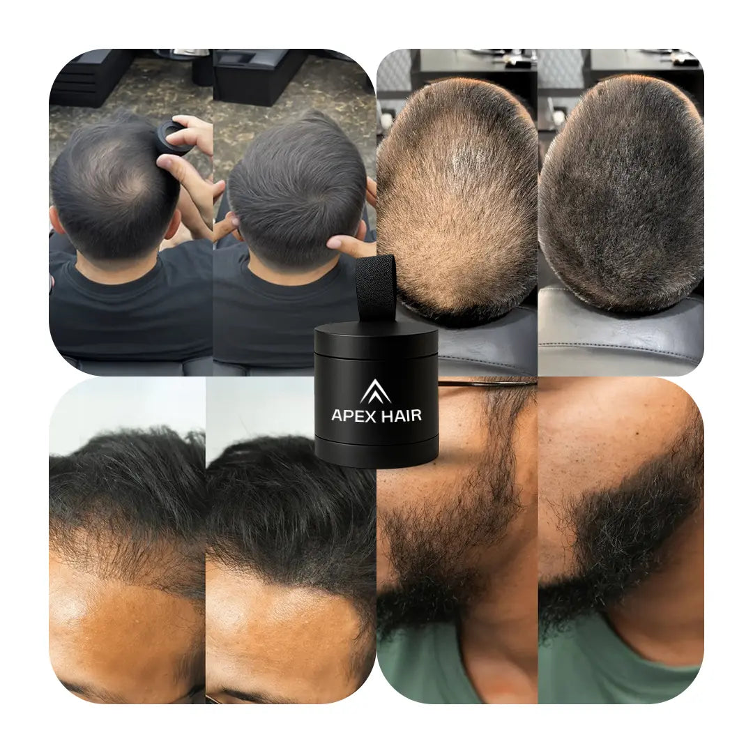 Apex Hair