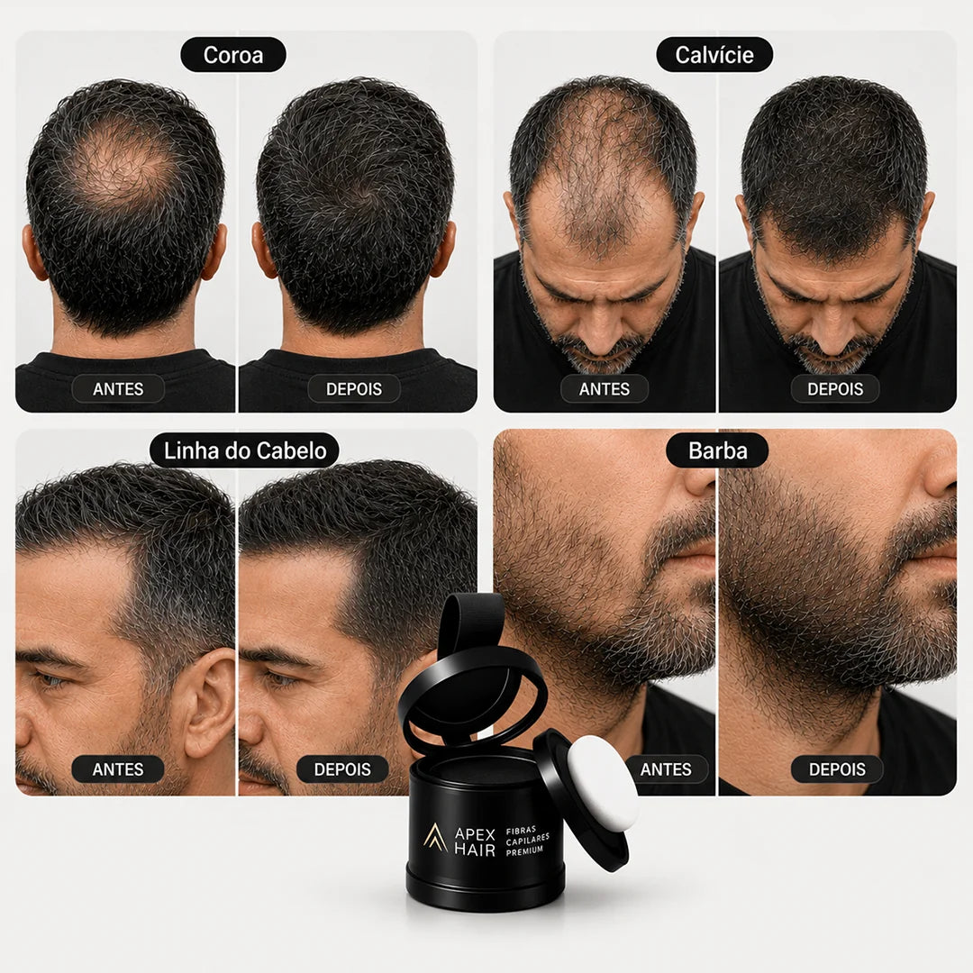 Apex Hair