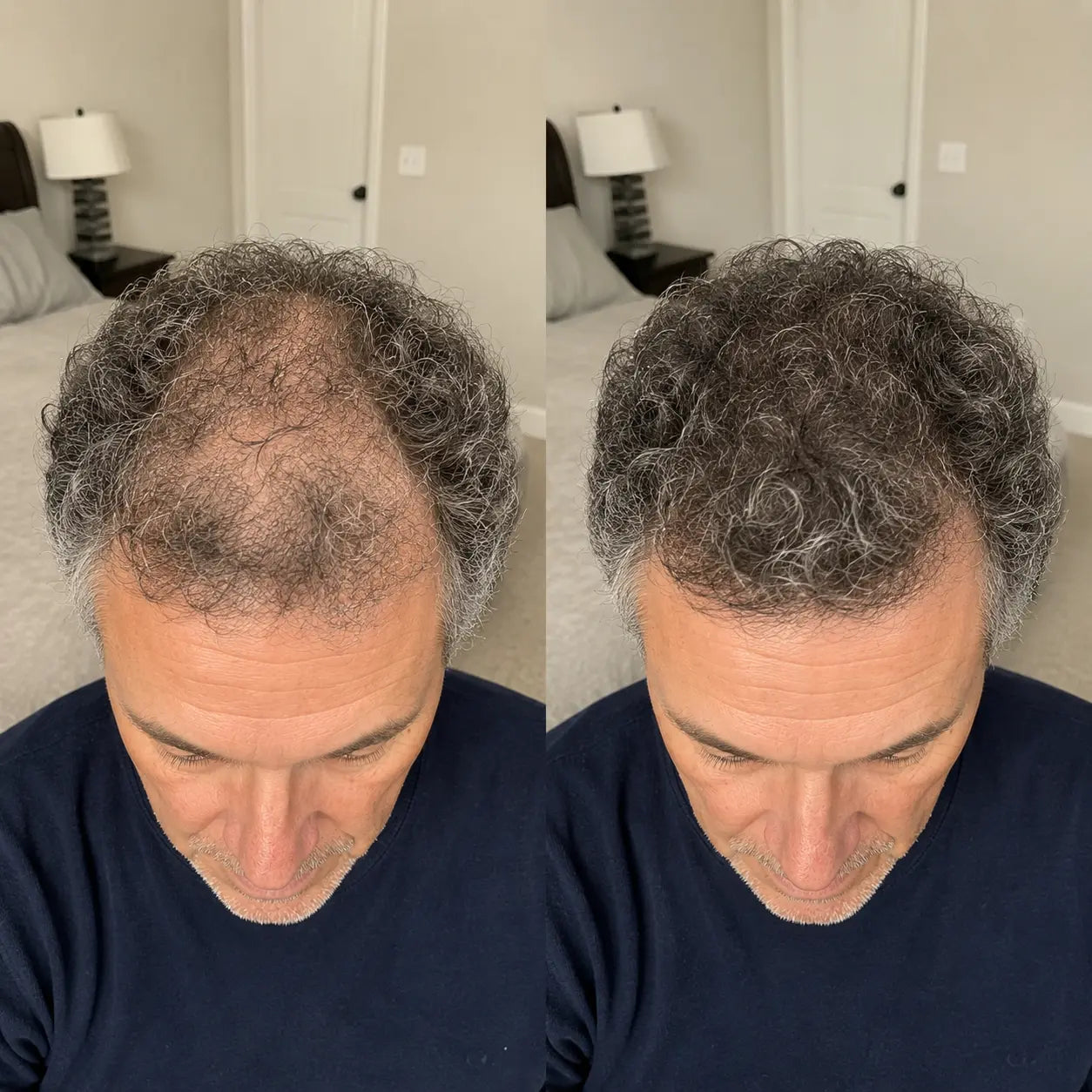 Apex Hair Men product showcase slide 3 — natural looking hair density