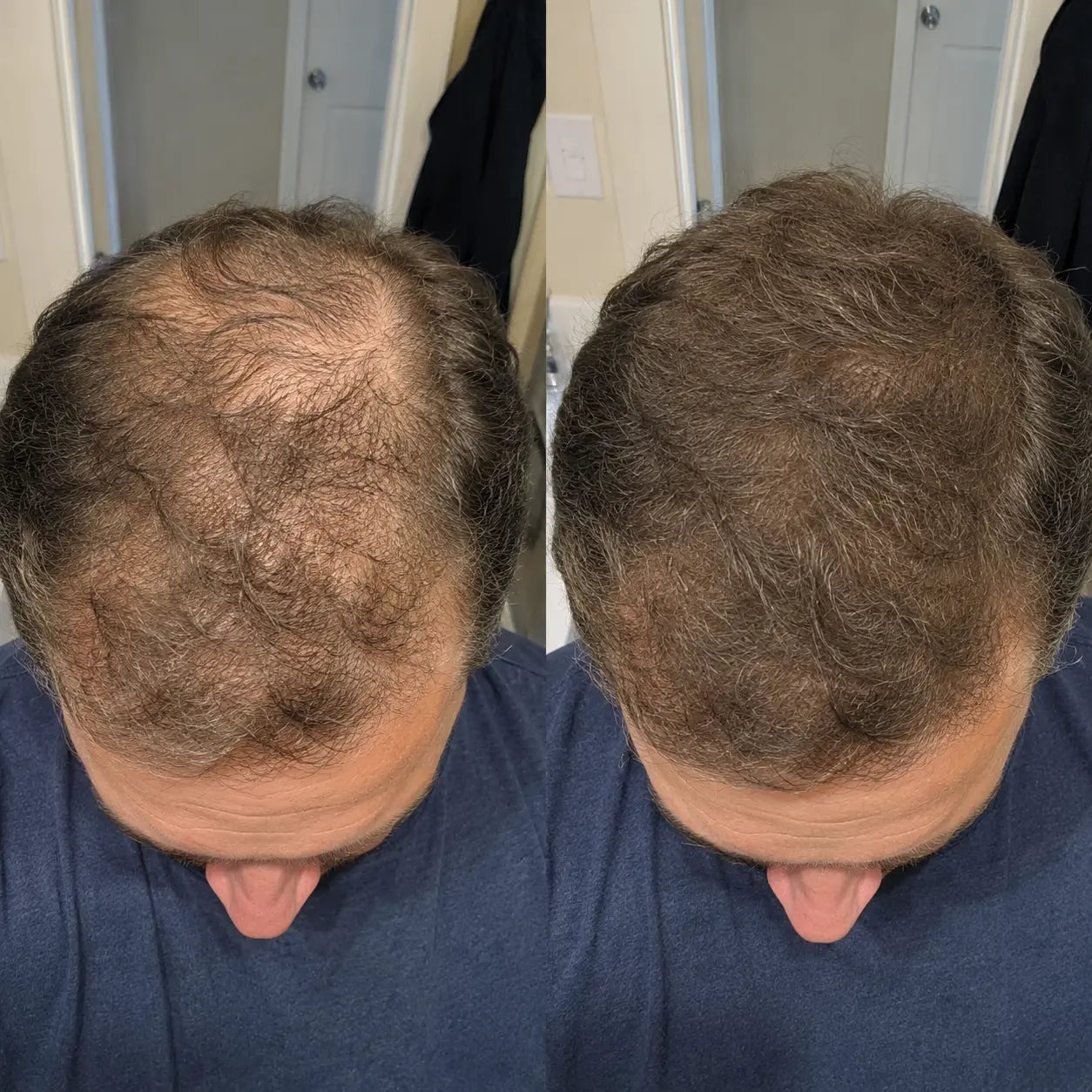 Apex Hair Men product showcase slide 7 — covers thinning areas