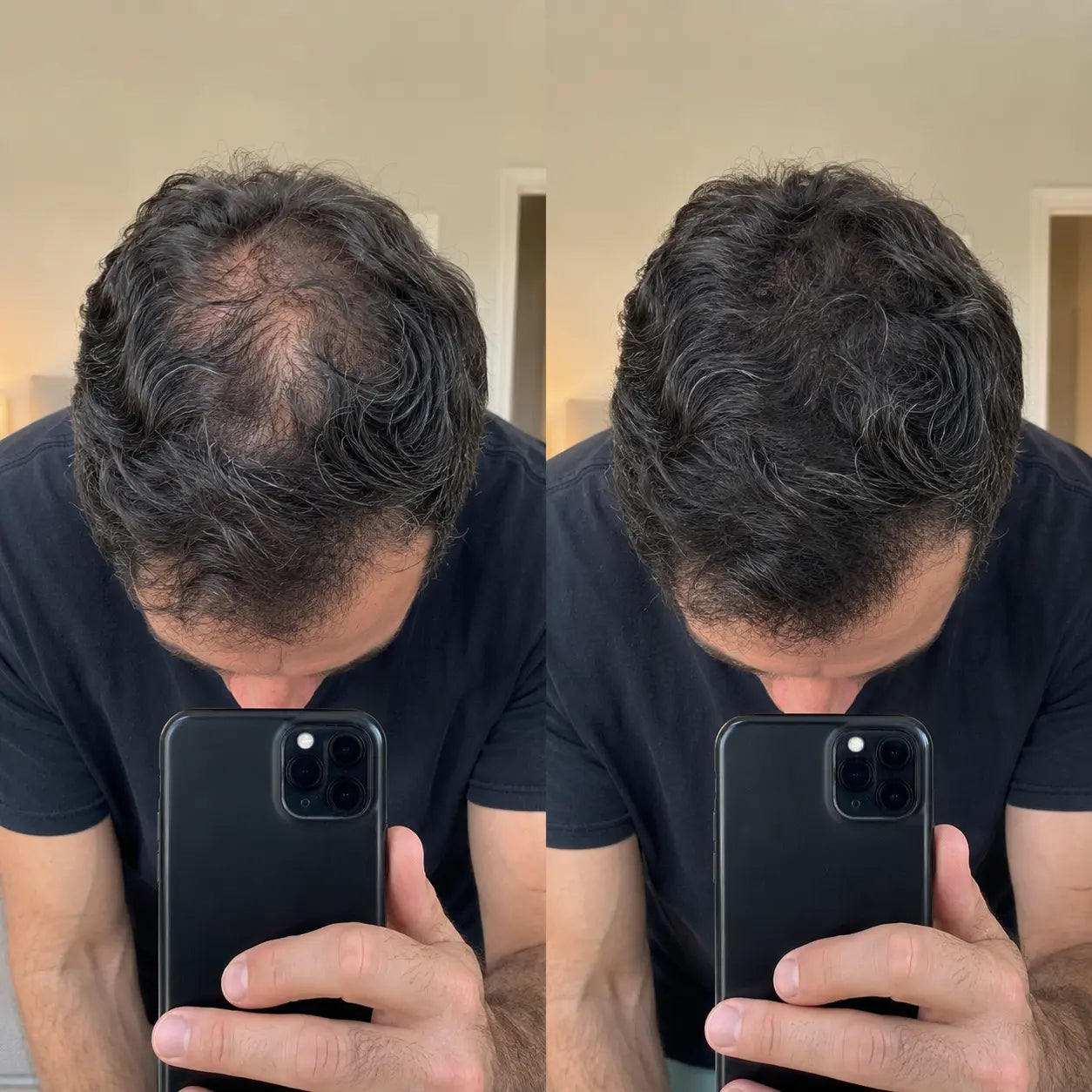 Apex Hair Men customer review — hair fiber application for thinning hair